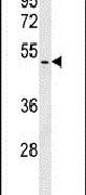 BABAM1 Antibody in Western Blot (WB)