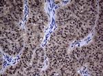 Hsp60 (HSPD1) Antibody in Immunohistochemistry (Paraffin) (IHC (P))