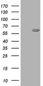 Hsp60 (HSPD1) Antibody in Western Blot (WB)