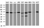 Hsp60 (HSPD1) Antibody in Western Blot (WB)