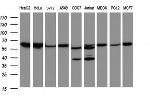 Hsp60 (HSPD1) Antibody in Western Blot (WB)
