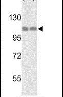 HSP105 Antibody in Western Blot (WB)
