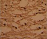 HTATSF1 Antibody in Immunohistochemistry (IHC)