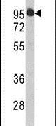 HTATSF1 Antibody in Western Blot (WB)