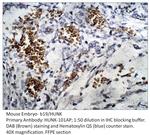 B19 Antibody in Immunohistochemistry (IHC)