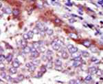 HUNK Antibody in Immunohistochemistry (IHC)