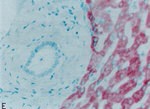 MBL2 Antibody in Immunohistochemistry (Paraffin) (IHC (P))