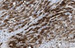 MBL2 Antibody in Immunohistochemistry (IHC)