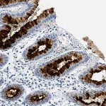 NGAL Antibody in Immunohistochemistry (IHC)