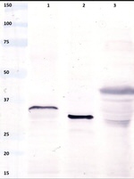 Gliadin Antibody in Western Blot (WB)
