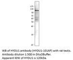 ORP150 Polyclonal Antibody