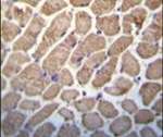 TSC1 Antibody in Immunohistochemistry (IHC)