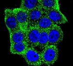 TSC1 Antibody in Immunocytochemistry (ICC/IF)