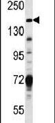 TSC1 Antibody in Western Blot (WB)