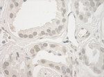 Haspin Antibody in Immunohistochemistry (IHC)