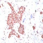 HSP70 Antibody in Immunohistochemistry (IHC)