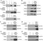 Hepatitis C Virus Core Antigen Antibody in Western Blot (WB)