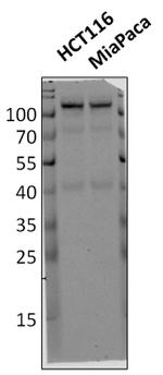 HK2 Antibody in Western Blot (WB)