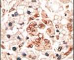 Hippocalcin Antibody in Immunohistochemistry (IHC)