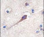 Hippocalcin Antibody in Immunohistochemistry (IHC)