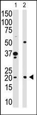 Hippocalcin Antibody in Western Blot (WB)