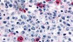 HRH4 Antibody in Immunohistochemistry (Paraffin) (IHC (P))