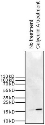 Phospho-Histone H3 (Ser10) Antibody in Western Blot (WB)