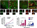 HuC/HuD Antibody in Immunohistochemistry (IHC)