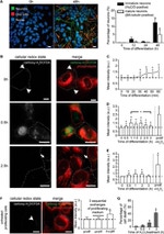 HuC/HuD Antibody in Immunocytochemistry (ICC/IF)