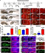 HuC/HuD Antibody in Immunohistochemistry (IHC)