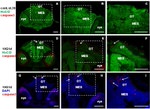 HuC/HuD Antibody in Immunohistochemistry (IHC)