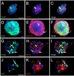 HuC/HuD Antibody in Immunocytochemistry (ICC/IF)