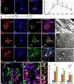 HuC/HuD Antibody in Immunohistochemistry (IHC)
