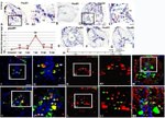 HuC/HuD Antibody in Immunohistochemistry (IHC)