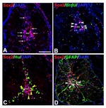 HuC/HuD Antibody in Immunohistochemistry (IHC)