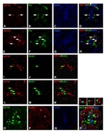 HuC/HuD Antibody in Immunohistochemistry (IHC)