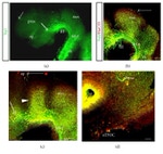 HuC/HuD Antibody in Immunohistochemistry (IHC)