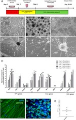 HuC/HuD Antibody in Immunocytochemistry (ICC/IF)