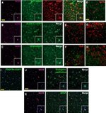 HuC/HuD Antibody in Immunohistochemistry (IHC)