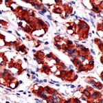Growth Hormone Polyclonal Antibody