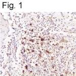 HHV-6 Envelope Monoclonal Antibody (F59G)