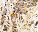 IARS2 Antibody in Immunohistochemistry (IHC)