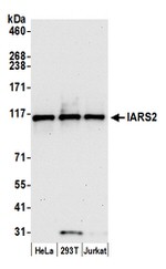 IARS2 Polyclonal Antibody