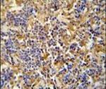 IBTK Antibody in Immunohistochemistry (IHC)