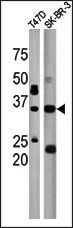 ICMT Antibody in Western Blot (WB)