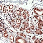 ID2 Antibody in Immunohistochemistry (IHC)