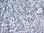 ID3 Antibody in Immunohistochemistry (Paraffin) (IHC (P))