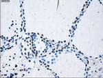 ID3 Antibody in Immunohistochemistry (Paraffin) (IHC (P))