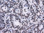 ID3 Antibody in Immunohistochemistry (Paraffin) (IHC (P))