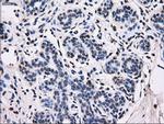 ID3 Antibody in Immunohistochemistry (Paraffin) (IHC (P))